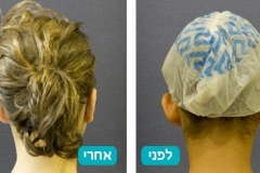 ears_v2_1-122-800-600-100
