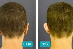 ears_v2_2-123-800-600-100