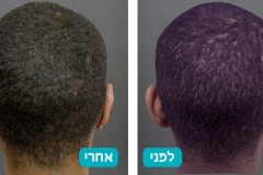 ears_v2_3-124-800-600-100