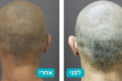 ears_v2_4-125-800-600-100