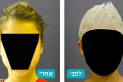 ears_v2_5-126-800-600-100