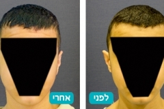 ears_v2_6-127-800-600-100