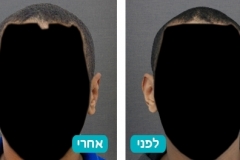 ears_v2_7-128-800-600-100