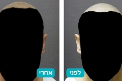 ears_v2_8-129-800-600-100